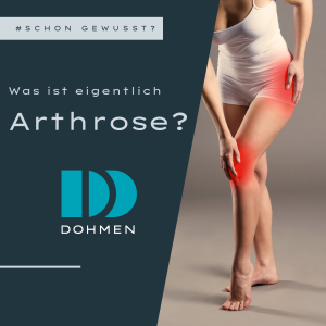 #schongewusst? - Was ist Arthrose? 