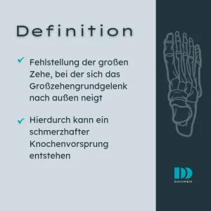 Was ist ein Hallux Valgus?
